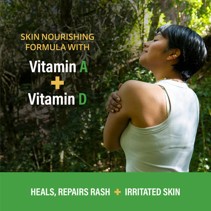 A+D Medicated Rash Ointment 15.2 oz – Soothes Poison Ivy, Eczema, Beard & Bikini Rash, Dry Skin