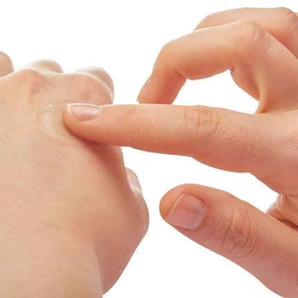 After Bite Xtra Insect Bite Treatment with Antihistamine – Strong Itch Relief (0006-1270)