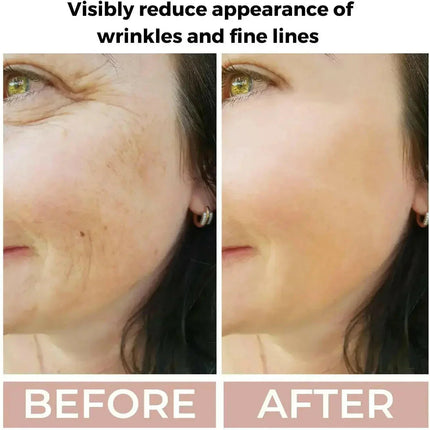 Retinol 3.5% Face Serum for Anti-Ageing & Skin Renewal | Ammuri