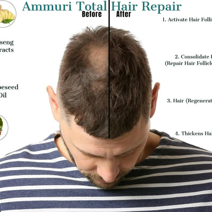 Natural Hair Oil for Hair Thinning & Scalp Nourishment (50ml) | Ammuri