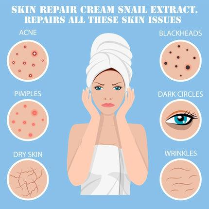 Snail Extract Skin Cream for Deep Repair & Hydration | Ammuri