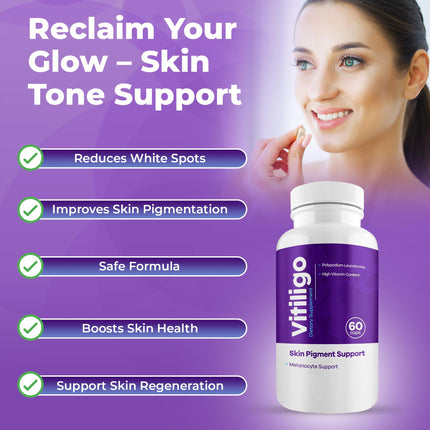 AURA VITAMINS Vitiligo Capsules – 60 Count | 1 Month Supply for Skin Pigmentation Support
