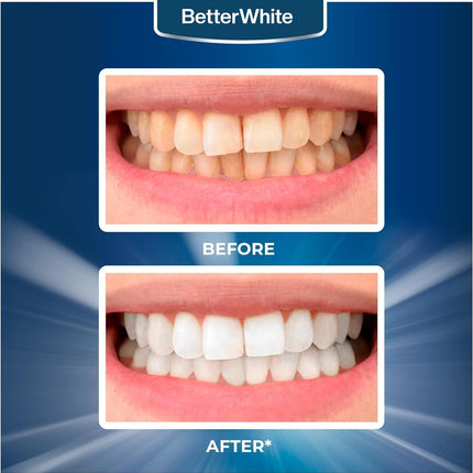 BetterWhite Professional Teeth Whitening Strips – Enamel Safe, Peroxide-Free, 14 Strips (7 Treatments)