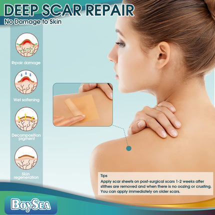 Boysea Professional Silicone Scar Sheets Roll 1.6x150 in | Reusable Scar Tape for Keloid, C-Section, Surgery, Burn & Acne