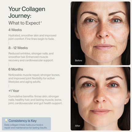 Colla Vita Collagen Peptides Powder – Grass-Fed, Hydrolyzed Type I & III, Unflavored 2 Pack (10 oz each, 30 Servings) | Hair, Skin, Nails & Joints
