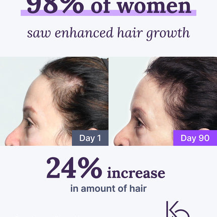 Keranique Hair & Scalp Supplements – Nourish, Strengthen & Support Fuller-Looking Hair