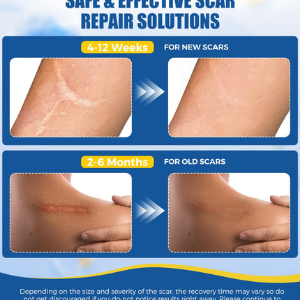 MasterMo Medical Grade Silicone Scar Sheets & Tape – 1.6x60 Roll, Ultra Soft & Hypoallergenic