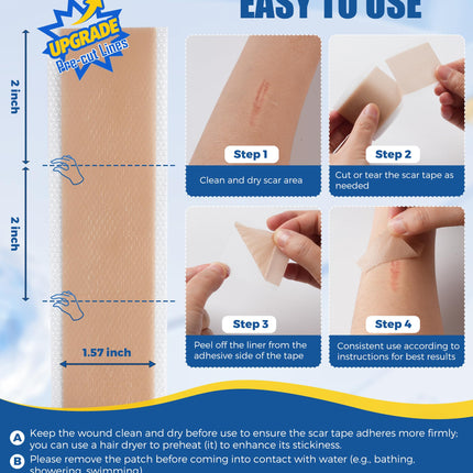 MasterMo Medical Grade Silicone Scar Sheets & Tape – 1.6x60 Roll, Ultra Soft & Hypoallergenic