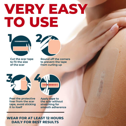 MYHELP Medical Grade Silicone Scar Tape - Transparent 1.6”x60” | Reusable, Hypoallergenic