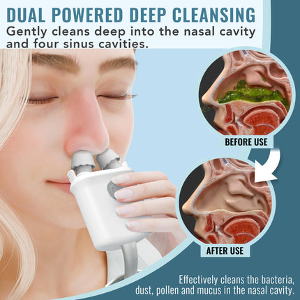 NASALFRESH MD Dual Powered Nasal Irrigation System – Rechargeable, 30 Saline Packets, 2 Nose Pillow Sets