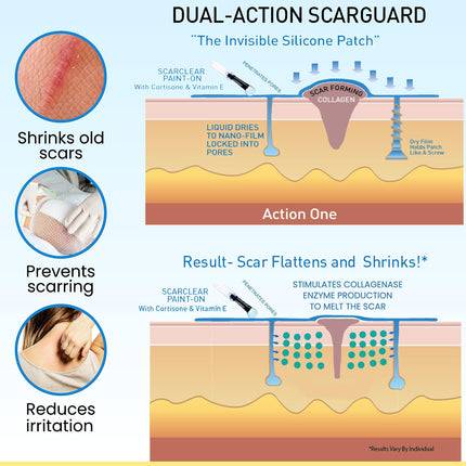 ScarGuard - Invisible Brush-On Silicone Liquid with Vitamin E for Scars (Keloids, Surgical, Burns)