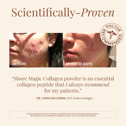 Shore Magic Marine Collagen Powder – Types I-IV, Unflavored, 9g Protein