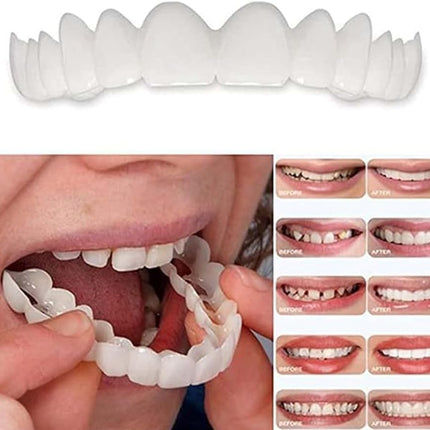 Temporary Smile Solution - 2 Pairs, Adjustable & Comfortable, Restores Confidence for All (1)
