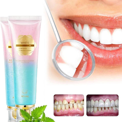 Niacinamide Whitening Toothpaste – 2 Pack | Fresh Breath & Stain Removal