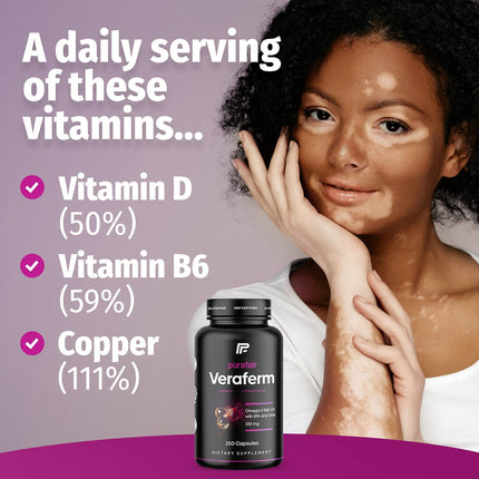 Veraferm Vitiligo Treatment – Improve Pigmentation & Reduce White Spots
