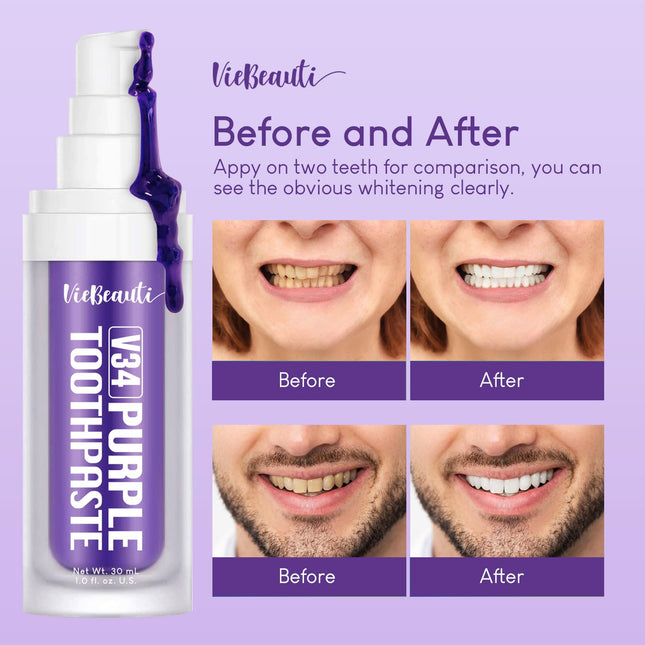 Viebeauti Purple Toothpaste for Teeth Whitening – Purple Color Corrector, 1 fl oz (30 ml)